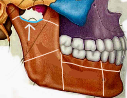<p>What part of the mandible?</p>