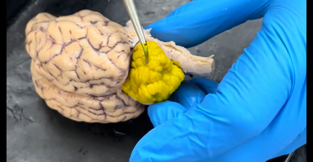 <p>Name the part of the brain being indicated by the probe and highlighted in yellow.</p>