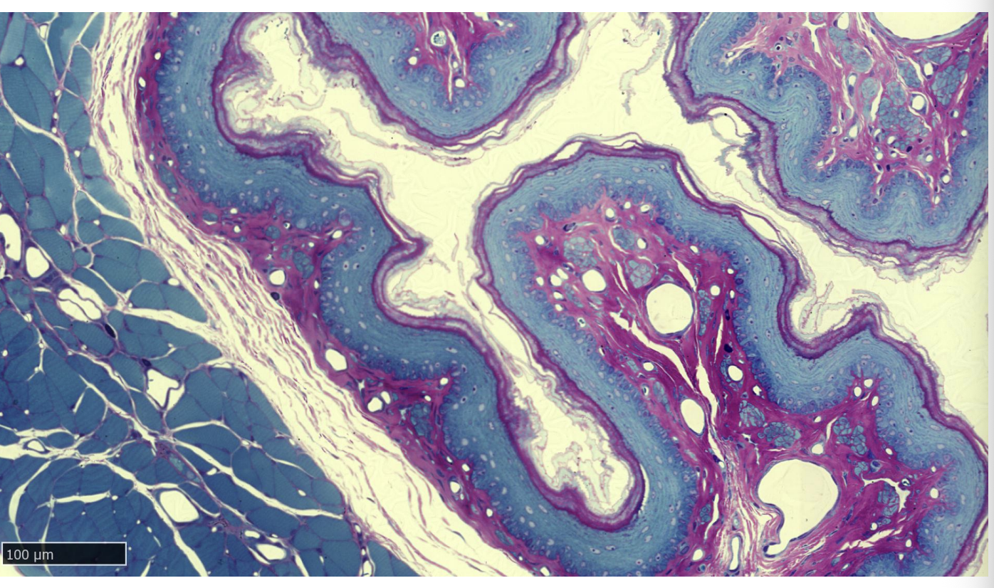 <ul><li><p>epithelia?</p></li></ul><p></p>