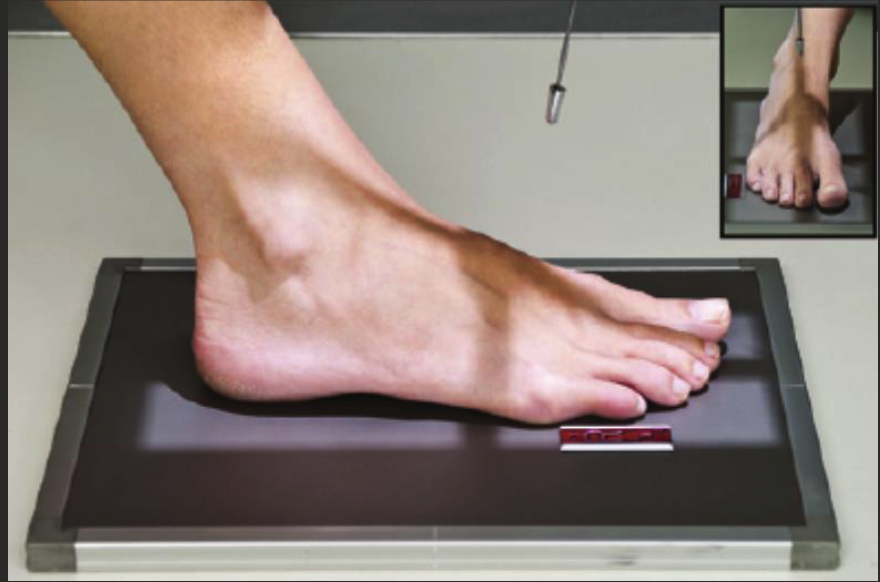 <ul><li><p>Patient sitting or lying on table, knee bent, sole of foot flat on IR.</p></li><li><p>Long axis of foot parallel to IR edge.</p></li><li><p>CR angled 5-15 degrees posterior (depending on foot arch).</p></li><li><p>Centre at BASE OF 3rd MT.</p></li><li><p>Collimate for skin edge of TOES AND HEEL.</p></li></ul><p></p>