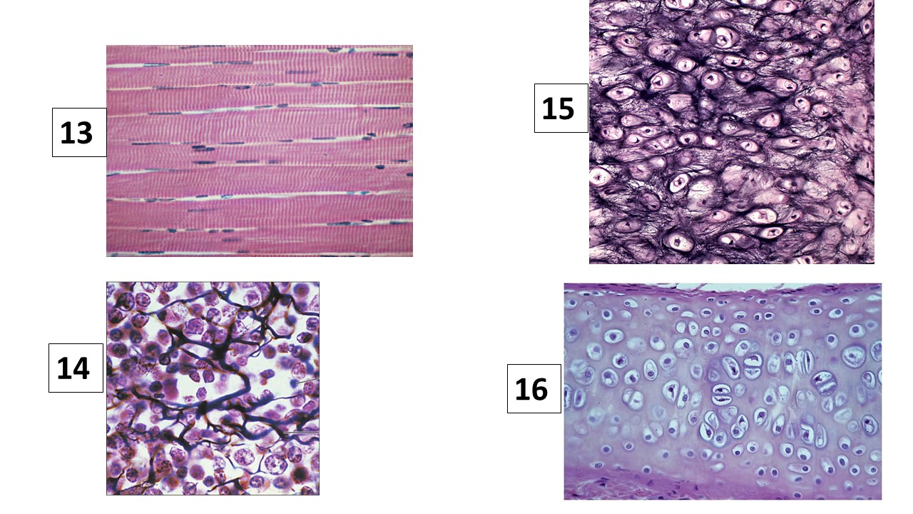 <p>Identify tissue #15</p>