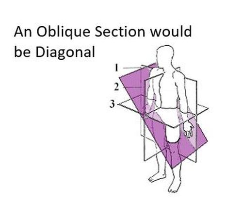 <p>Oblique Plane</p>