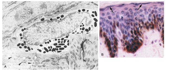 <ul><li><p>melanocytes have a small cytoplasmic granules or inclusions called __ which store melanin pigment</p></li><li><p>inject these granules into neighboring newly formed epithelial cells of basal layer</p></li></ul><p></p>
