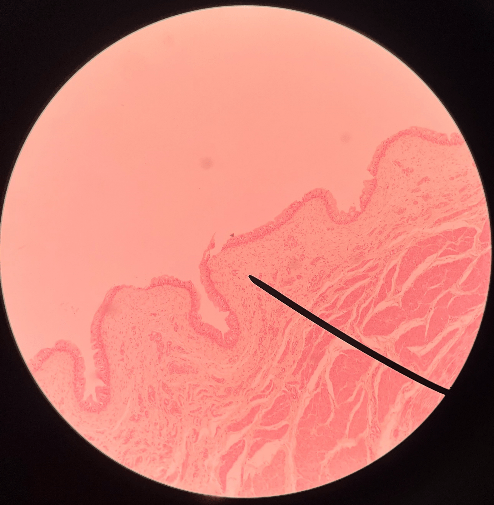 • Slide histology of the bladder.

• A layer of the bladder.

• Superficial to the mucosa and deep to the muscularis.