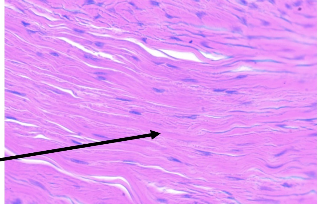 <p>Identify the type of tissue and the<br>structure at the arrow</p>