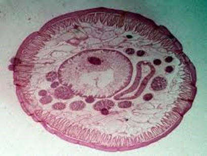 bLongitudinal muscles and circular muscles to allow for characteristic undulating movement