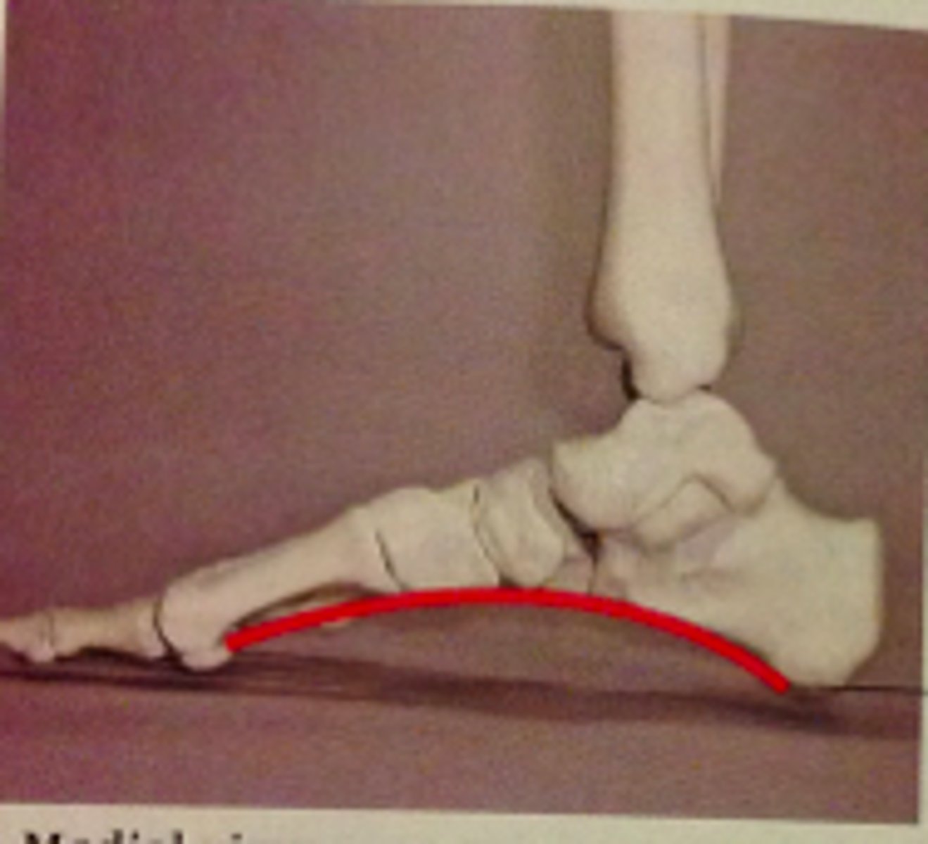 <p>-highest of three arches</p><p>-Extends from heel to great toe</p><p>-Formed from calcaneus, talus, navicular, cuneiform, and metatarsals I-III</p>