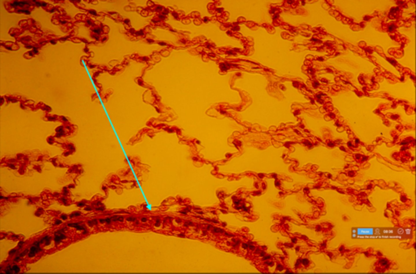 <p>This is a slide showing a respiratory bronchiole. What type of cells lines this bronchiole?</p>