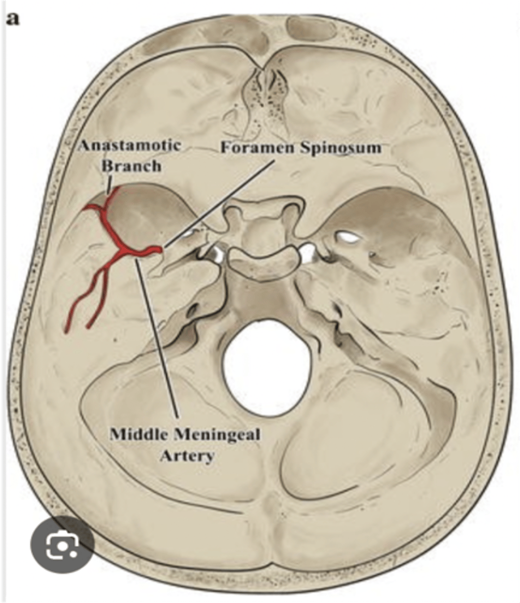 <p>Middle meningeal artery</p>