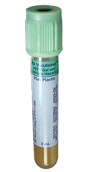 <p>Light Green</p>