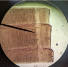 <p>is this proglottid mature of immature</p>