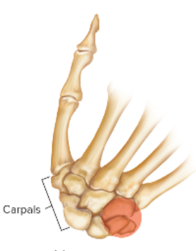 <p>What is this image an example of </p>