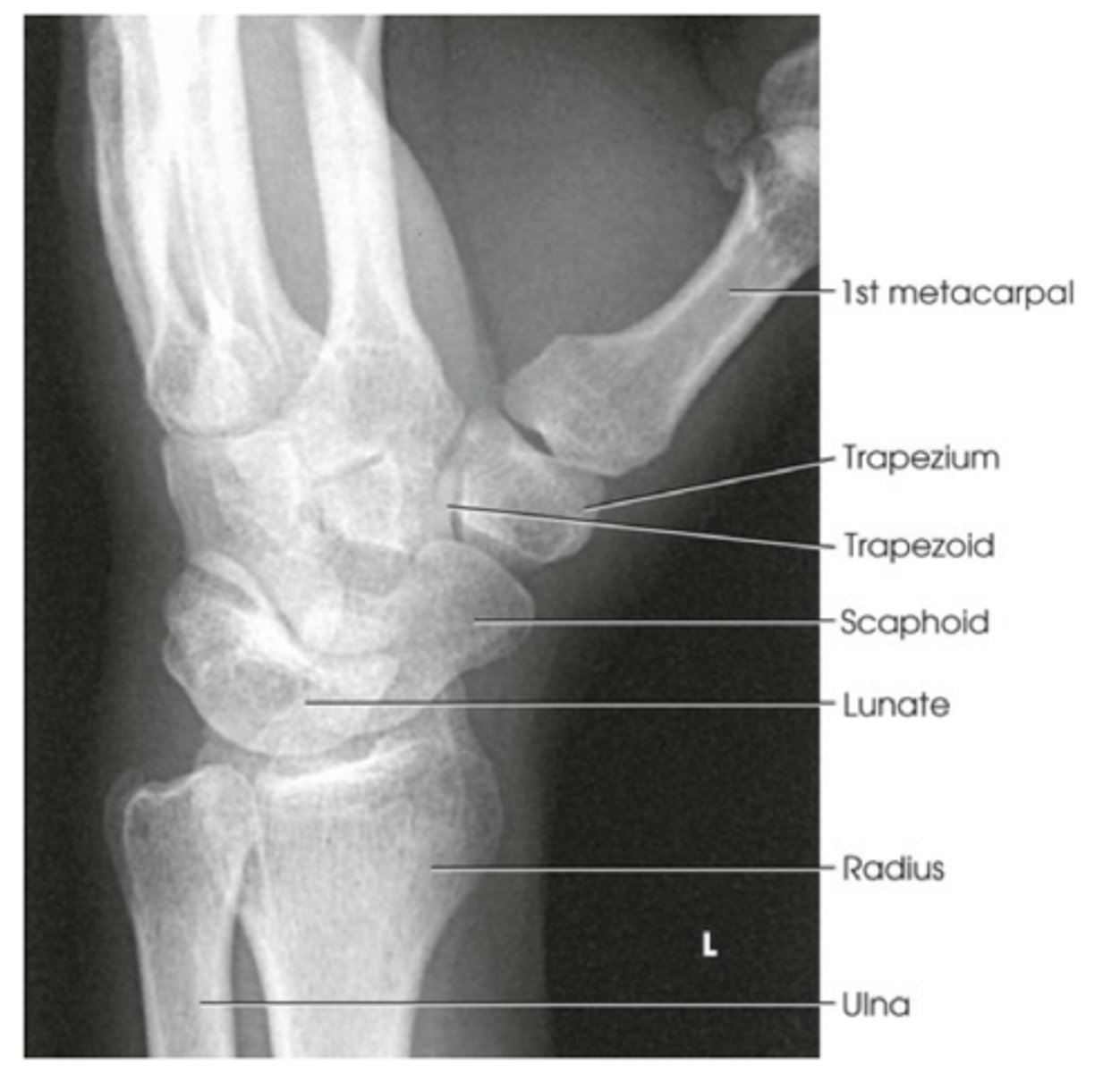 <p>-Distal radius, ulna, and carpals demonstrated</p><p>-45 degrees rotation, slight overlap of distal radius and ulna</p><p>-Trapezium seen in its entirety and distal half of scaphoid without imposition</p><p>-carpals on lateral side of wrist</p>