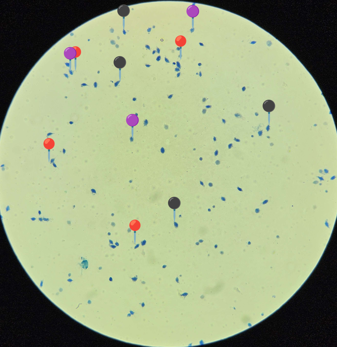 <p><strong><em>Trichomonas vaginalis</em></strong></p><p>(Trofozoit)</p><p></p><p></p><p><strong>Organelle:</strong></p><p></p><ul><li><p><span data-name="red_circle" data-type="emoji">🔴</span><span data-name="yellow_circle" data-type="emoji">🟡</span><span data-name="green_circle" data-type="emoji">🟢</span><span data-name="blue_circle" data-type="emoji">🔵</span><span data-name="purple_circle" data-type="emoji">🟣</span><span data-name="black_circle" data-type="emoji">⚫</span><span>️</span><span data-name="white_circle" data-type="emoji">⚪</span><span data-name="brown_circle" data-type="emoji">🟤</span></p></li></ul><p></p><ul><li><p><span data-name="red_circle" data-type="emoji">🔴</span><span data-name="yellow_circle" data-type="emoji">🟡</span><span data-name="green_circle" data-type="emoji">🟢</span><span data-name="blue_circle" data-type="emoji">🔵</span><span data-name="purple_circle" data-type="emoji">🟣</span><span data-name="black_circle" data-type="emoji">⚫</span><span>️</span><span data-name="white_circle" data-type="emoji">⚪</span><span data-name="brown_circle" data-type="emoji">🟤</span></p></li></ul><p></p><ul><li><p><span data-name="red_circle" data-type="emoji">🔴</span><span data-name="yellow_circle" data-type="emoji">🟡</span><span data-name="green_circle" data-type="emoji">🟢</span><span data-name="blue_circle" data-type="emoji">🔵</span><span data-name="purple_circle" data-type="emoji">🟣</span><span data-name="black_circle" data-type="emoji">⚫</span><span>️</span><span data-name="white_circle" data-type="emoji">⚪</span><span data-name="brown_circle" data-type="emoji">🟤</span></p></li></ul><p></p><p></p><p><strong>Parazytoza:</strong> <em>Rzęsistkowica</em></p><p></p>