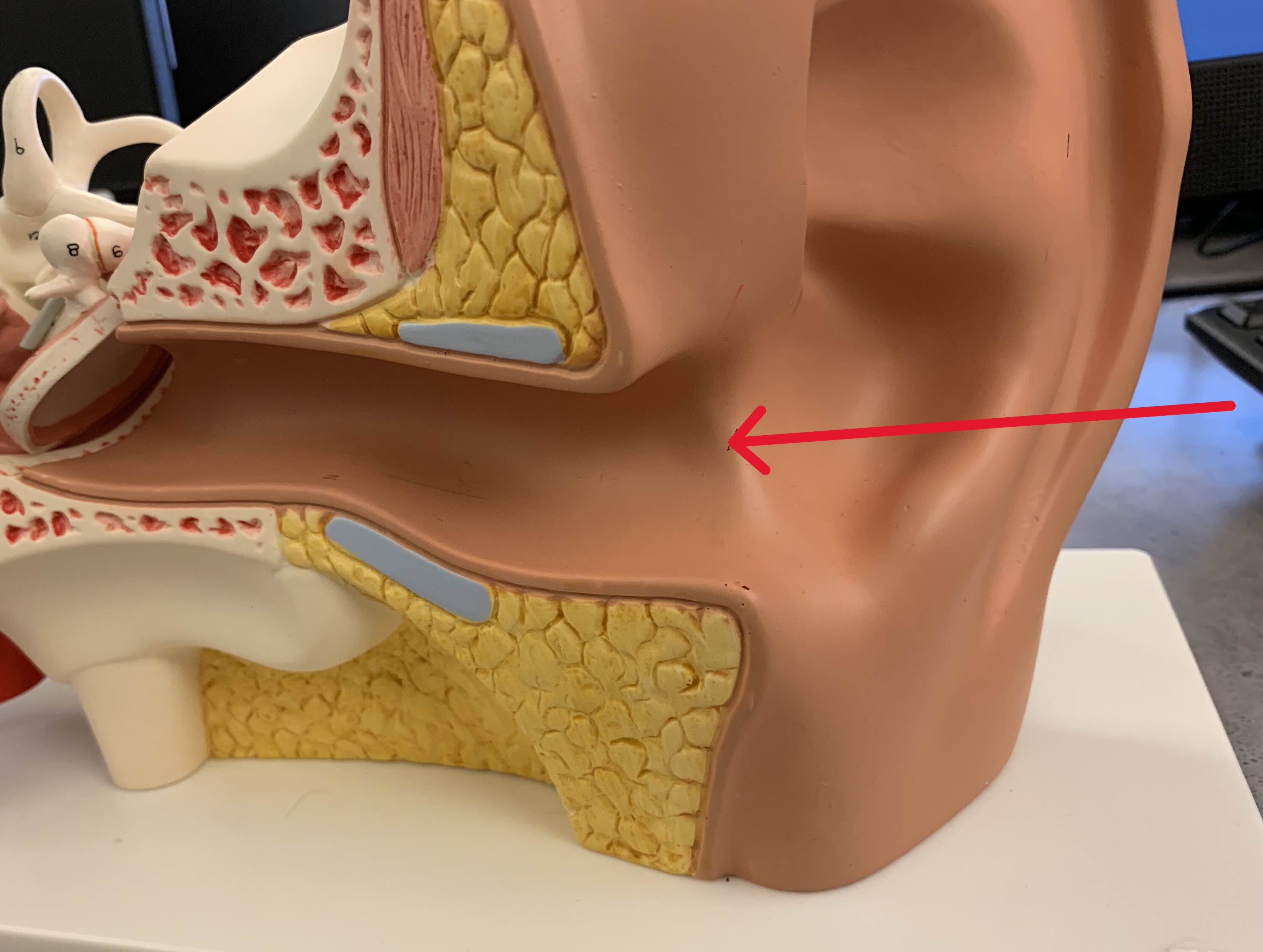 <p>Which part of the ear is:</p><ul><li><p>Earhole</p></li></ul><p></p>