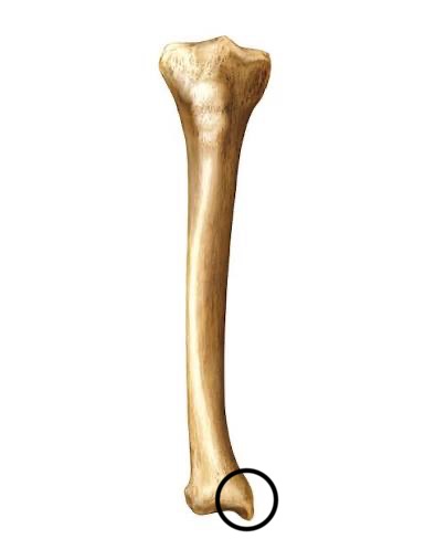 <p>what part of the tibia is this?</p>