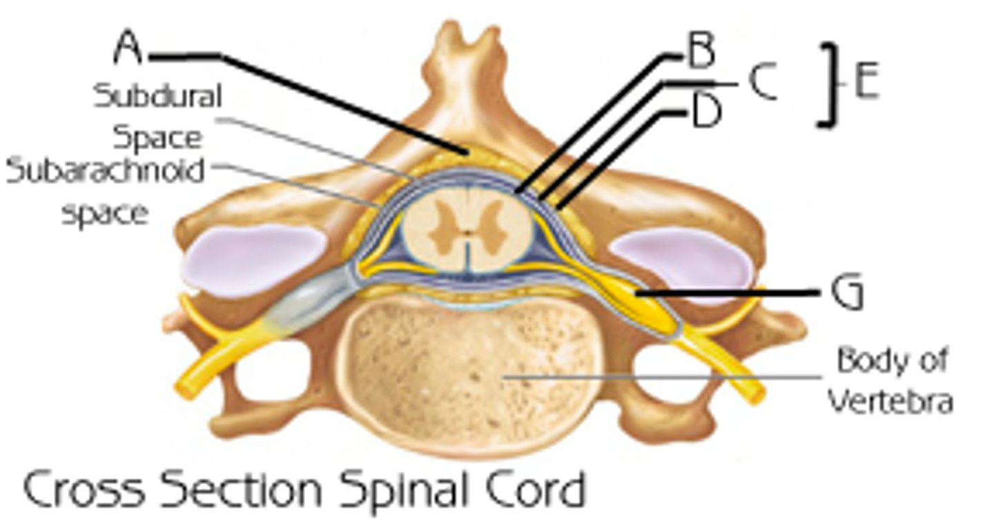 <p>space between the dura mater and the wall of the vertebral canal (A)</p>