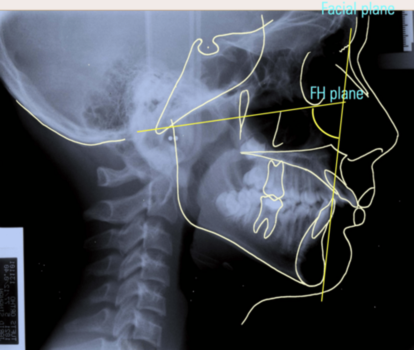 <p>ID the measurement being taken:</p>
