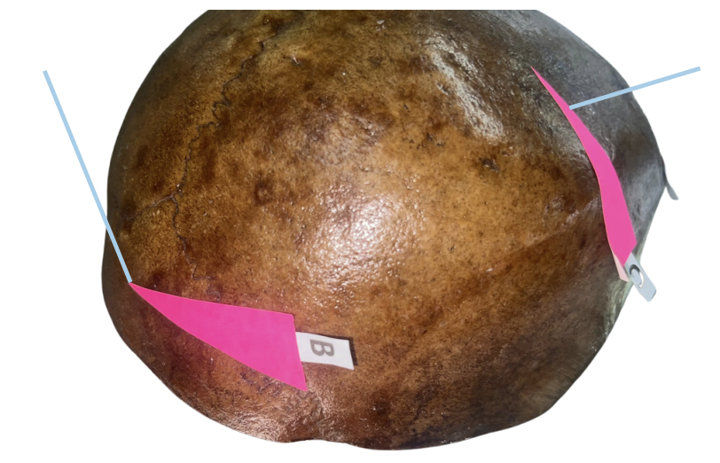 <p>Identify the bone structure labeled as B.</p>