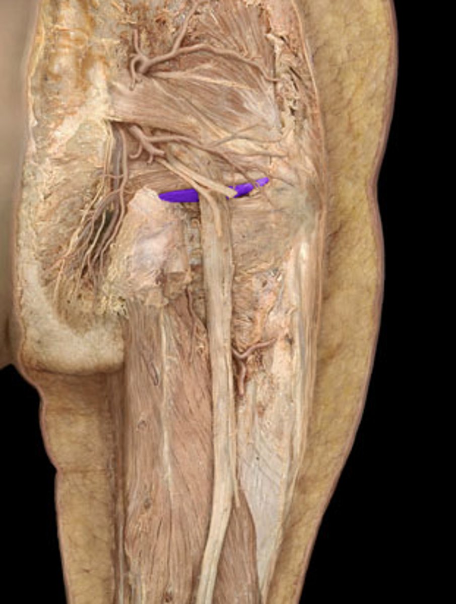 <p>laterally rotate extended hip joint and abduct hip joint when flexed; stabilize hip joint</p>