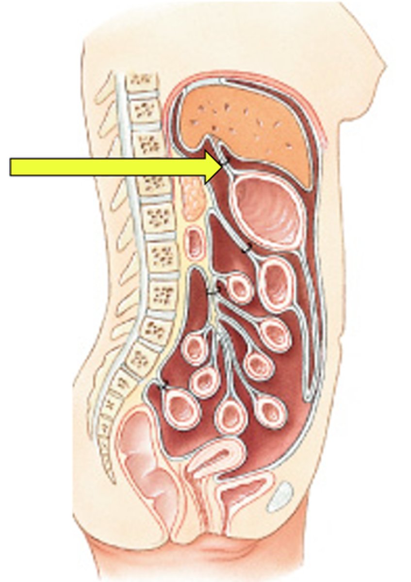<p>Anchors the liver to the stomach</p>