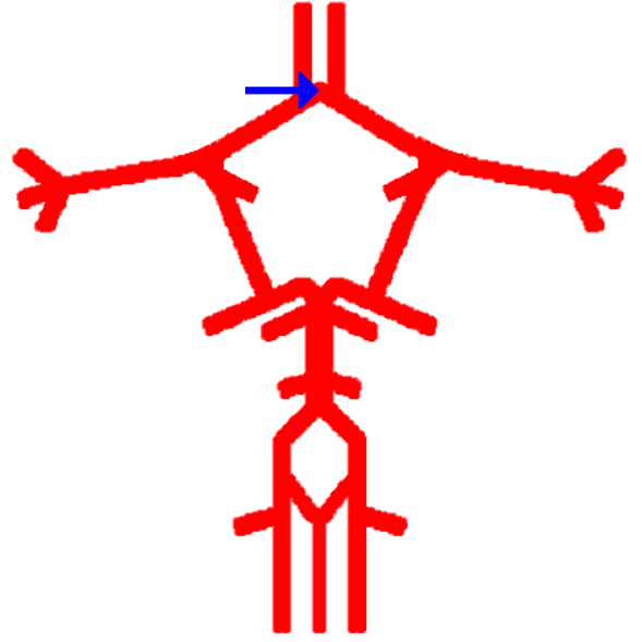 <p>Label this cerebral artery</p>