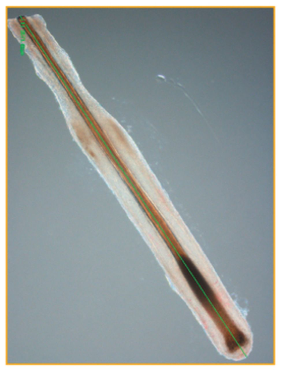 <p>cavity or sac from which the hair originates</p>