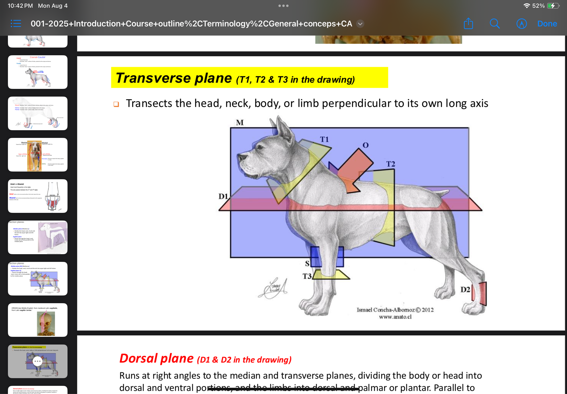 <p>Transverse plane</p>