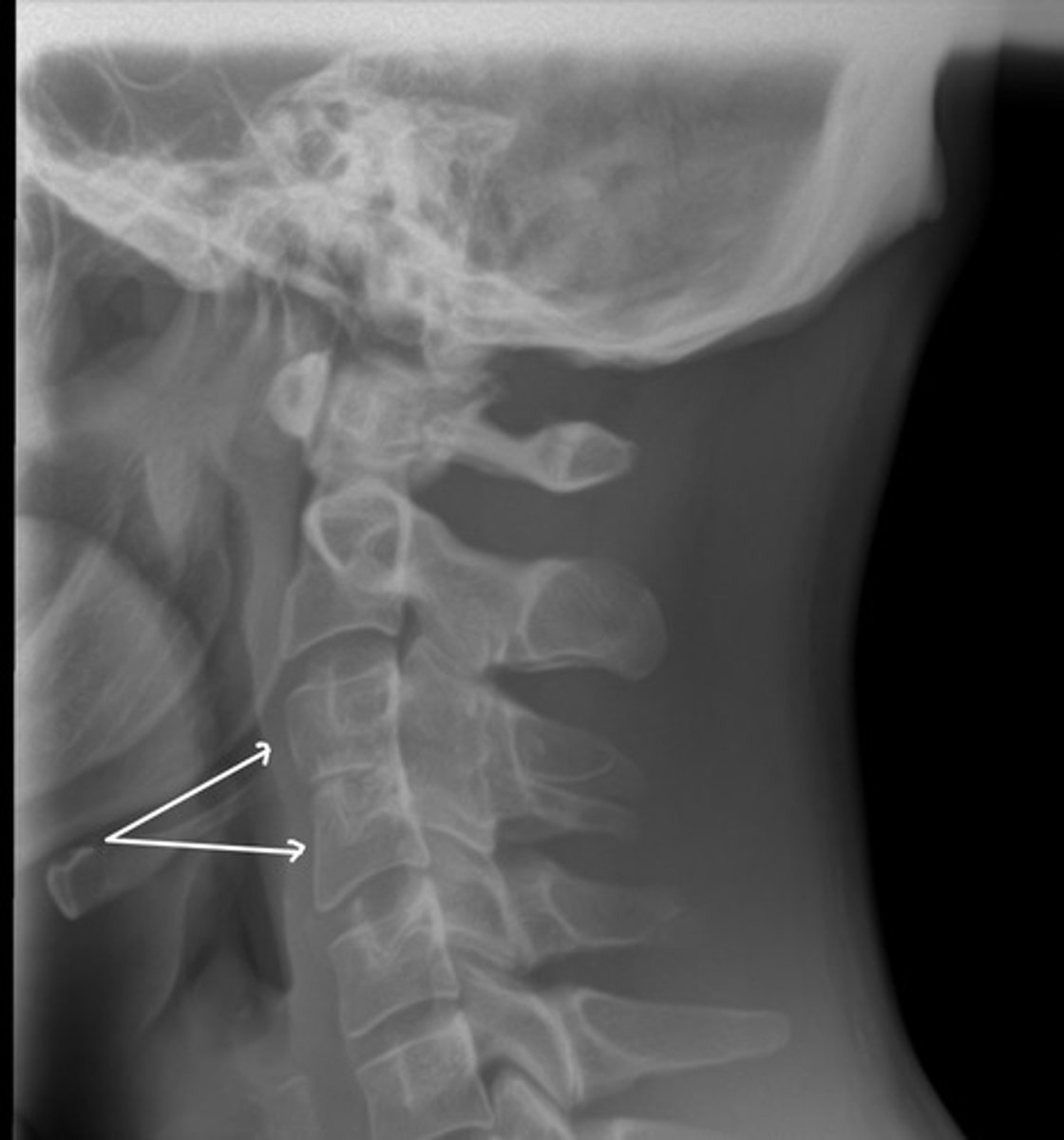 <p>What are we looking at here?</p>