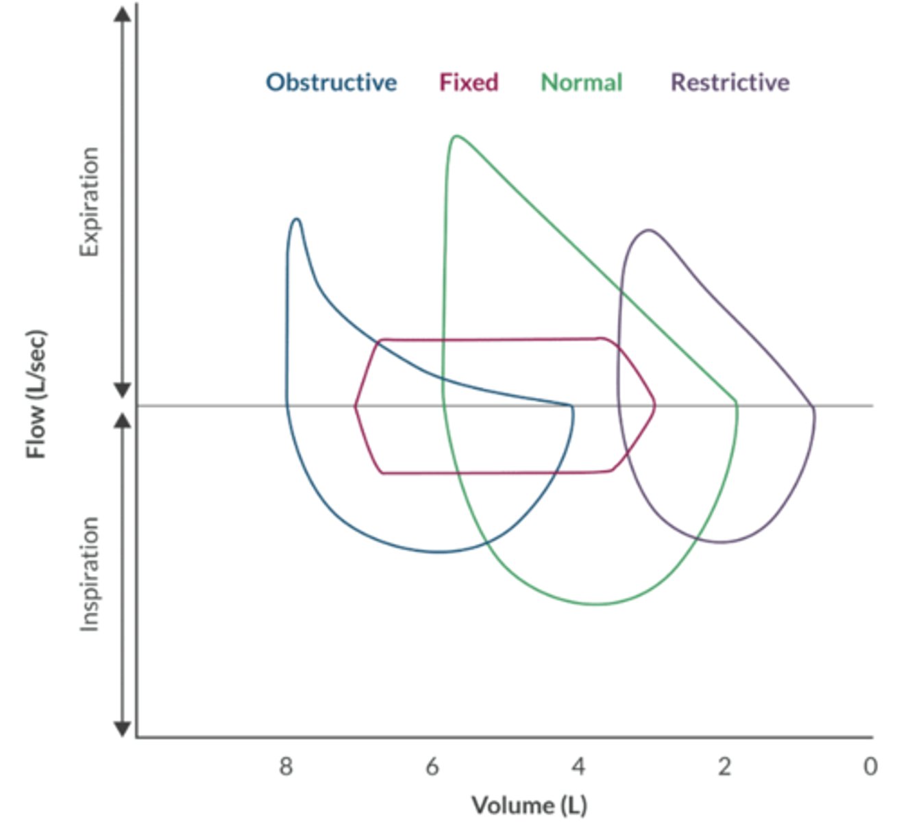 <p>Normal: upside down ice cream cone. </p><p>Obstructive: normal inspiration with expiratory obstruction.</p><p>Restrictive: shape is similar to normal loop, but the restrictive loop is smaller and right-shifted. </p><p>Fixed Obstruction: inspiration and expiration are affected. An extra thoracic obstruction is abnormal during inspiration and normal during expiration. An intra thoracic obstruction is normal during inspiration and abnormal during expiration. </p>