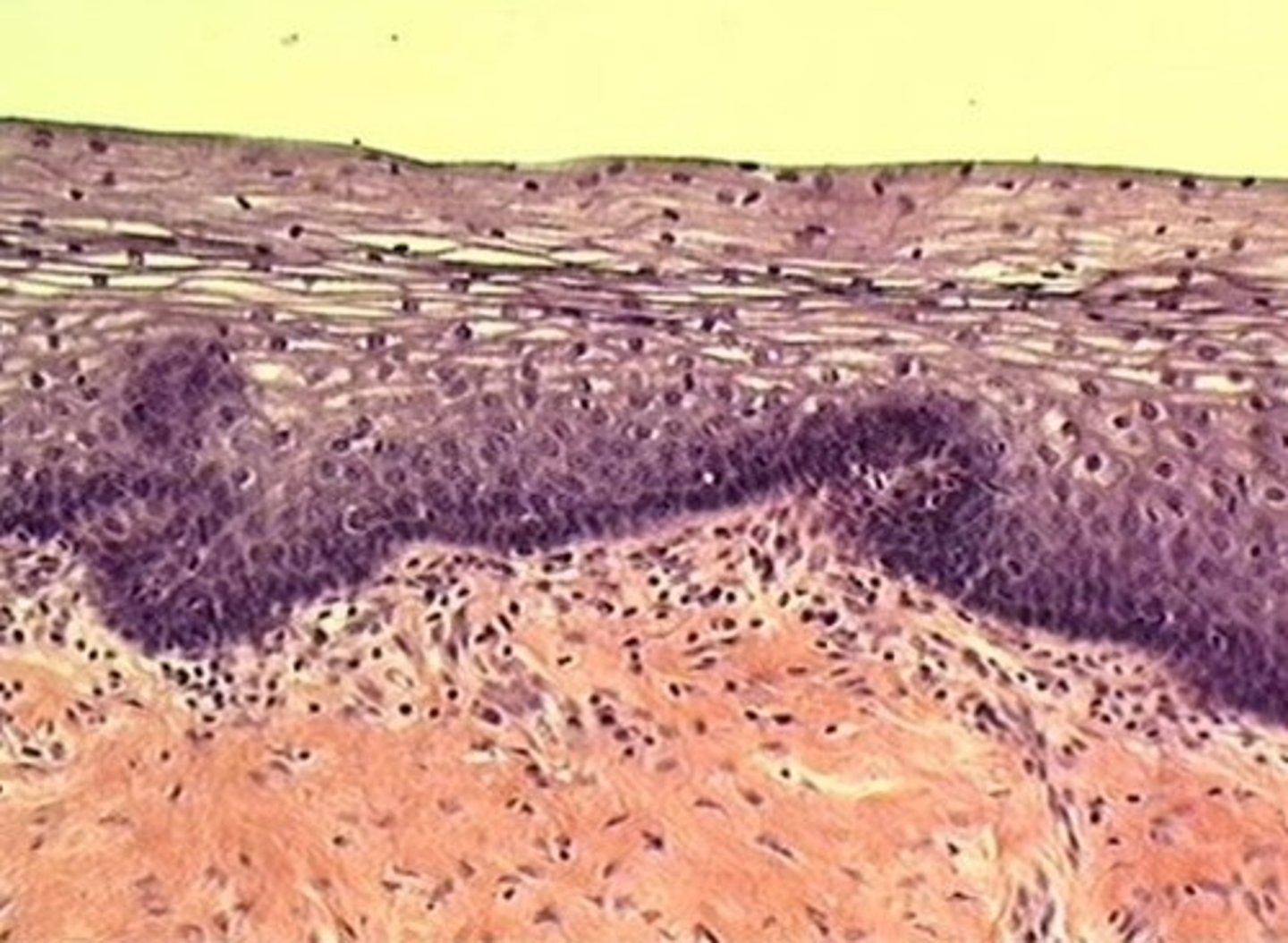 <p>lumen of the vagina</p>