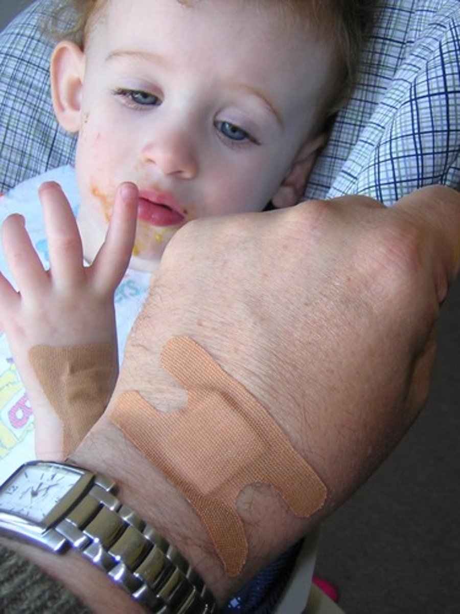 <p>Feelings of pity and sorrow for someone else's misfortune.</p>