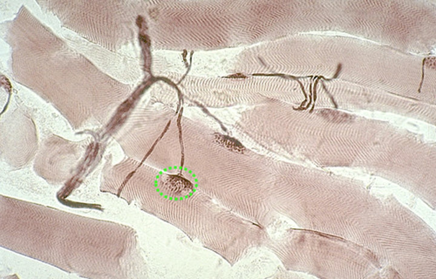 <p>What type of effector makes contact with a lower motor neuron in the somatic nervous system?</p>