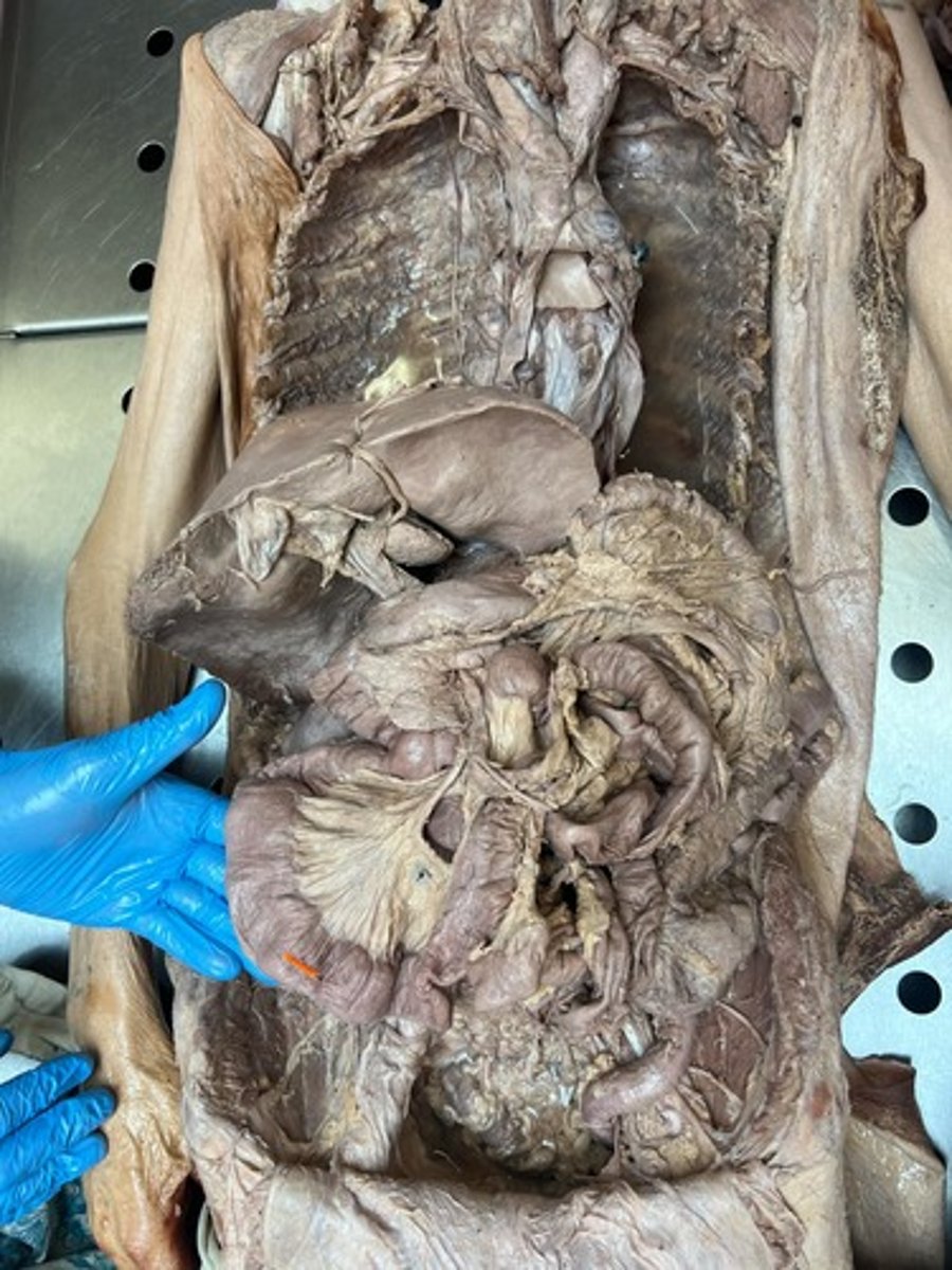 <p>ileum</p>