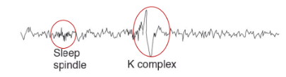 <p>Sleep begins - irregular activity and also <strong>sleep spindles</strong><mark data-color="#d5fcf5" style="background-color: #d5fcf5; color: inherit"> (12-14Hz)</mark> (although these also occur in other stages of sleep) and <strong>K complexes</strong></p>