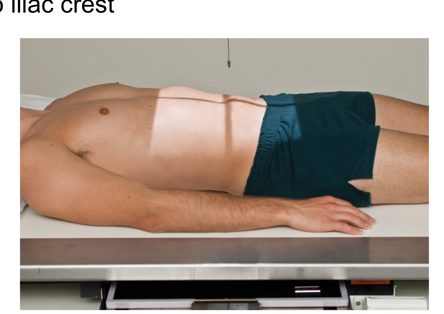 <p>Anteroposterior view of the abdomen with the patient lying on their back; used in routine abdominal imaging.</p>