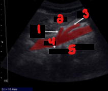 <p>Label the crossed-out structures on this image.&nbsp;</p>