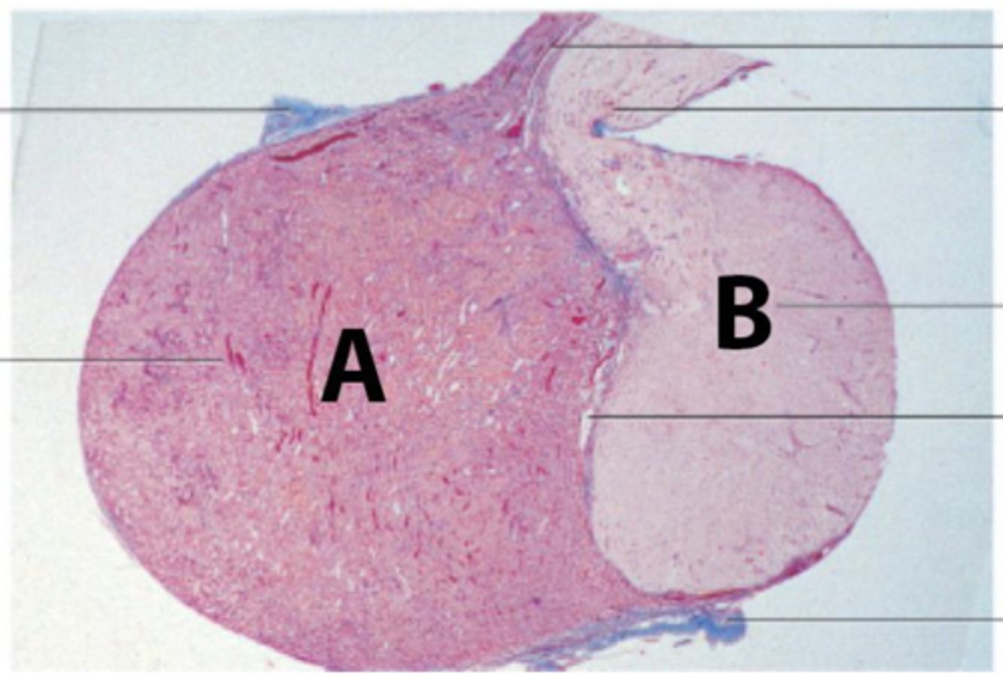 <p>List 6 hormones secreted by anterior pituitary gland (adenohypophysis), a high magnification session from part A is shown below in the second picture.</p>