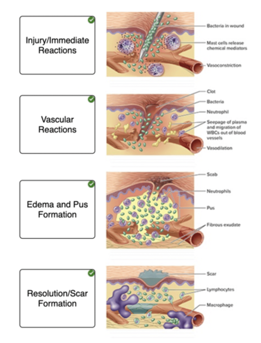 <p>injury/immediate release</p><p>vascular reactions</p><p>edema and pus formation</p><p>resolution/scar formation</p>