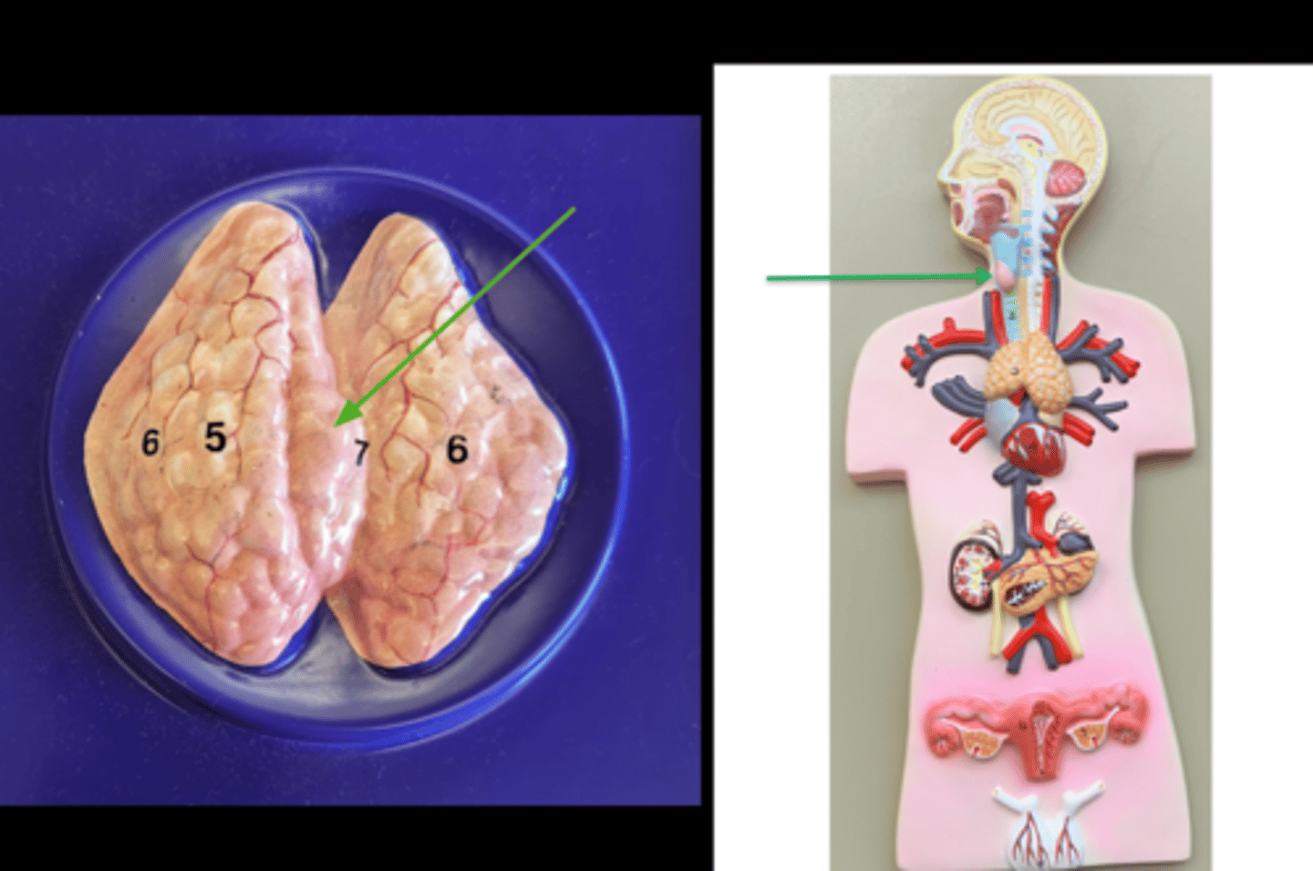 <p>Name this gland</p>