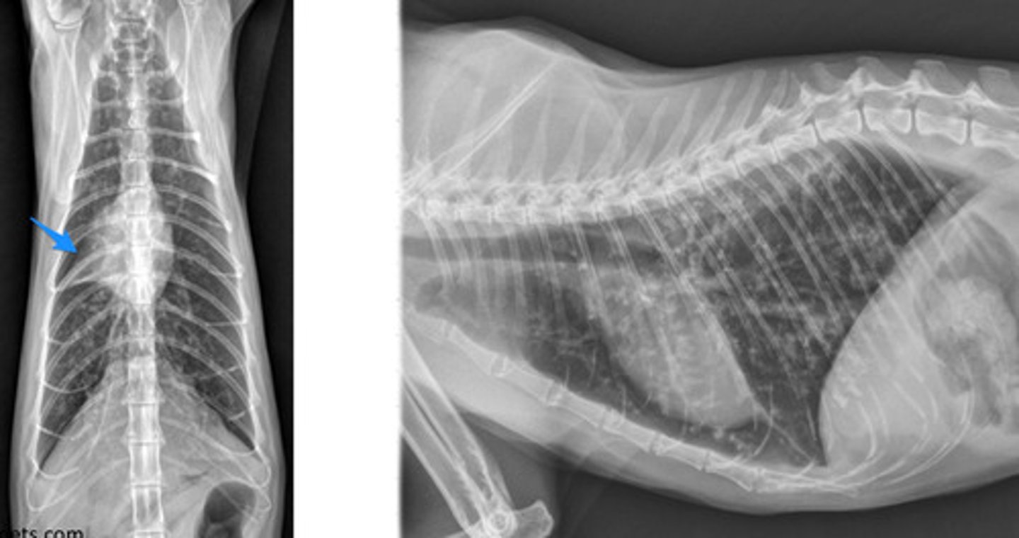 <p>caudal end of the scapula to the diaphragm/last rib.</p>