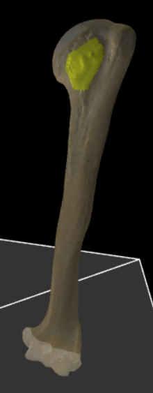<p>Kleine knobbel meer naar voor en onder ten opzichte van het tuberculum majus.</p>