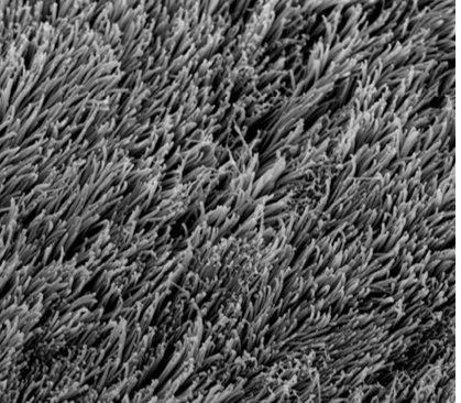 <p>Cilia → consistent length and density, no branching, longer and not as dense as microvilli</p>