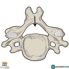 <p>The large opening posterior to the vertebral body - passage for the spinal cord</p>