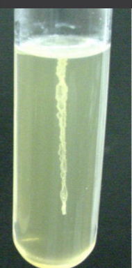<p>Motility Reaction results</p>