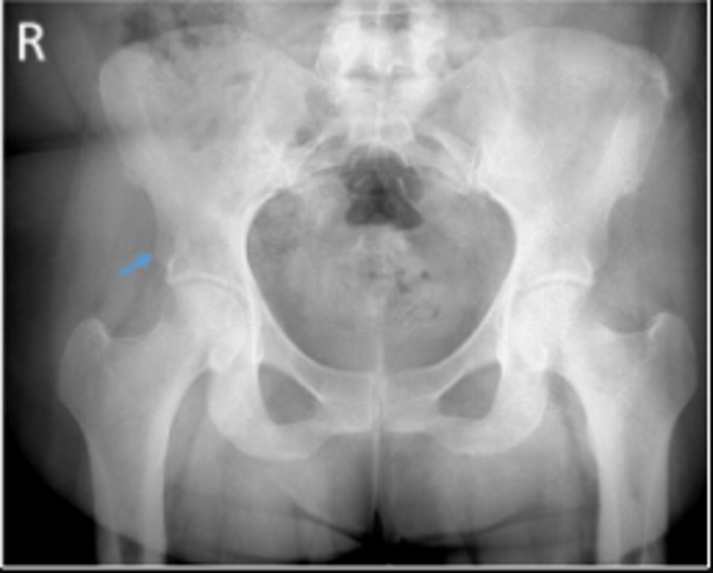 <p>What are the arrows pointing to?</p>