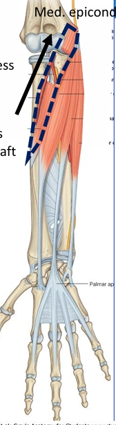 <p>Name this muscle </p>
