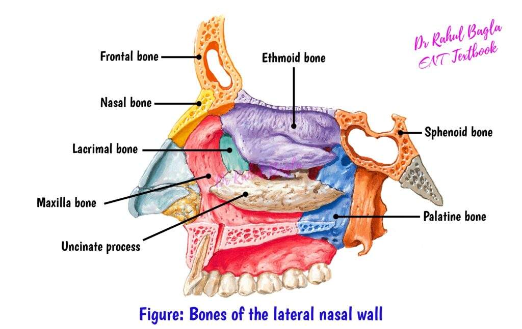 <p>The nasal cavity is bordered by the frontal, nasal, lacrimal, maxilla, sphenoid and palatine bone. The paranasal sinuses are found inside the frontal and sphenoid bone.</p>