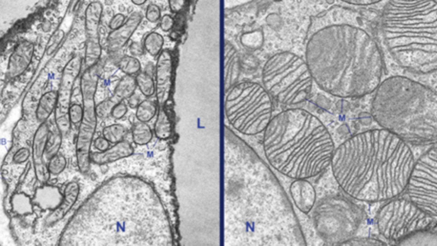 <p>what type of mitochondria is shown on the right vs the left?</p>