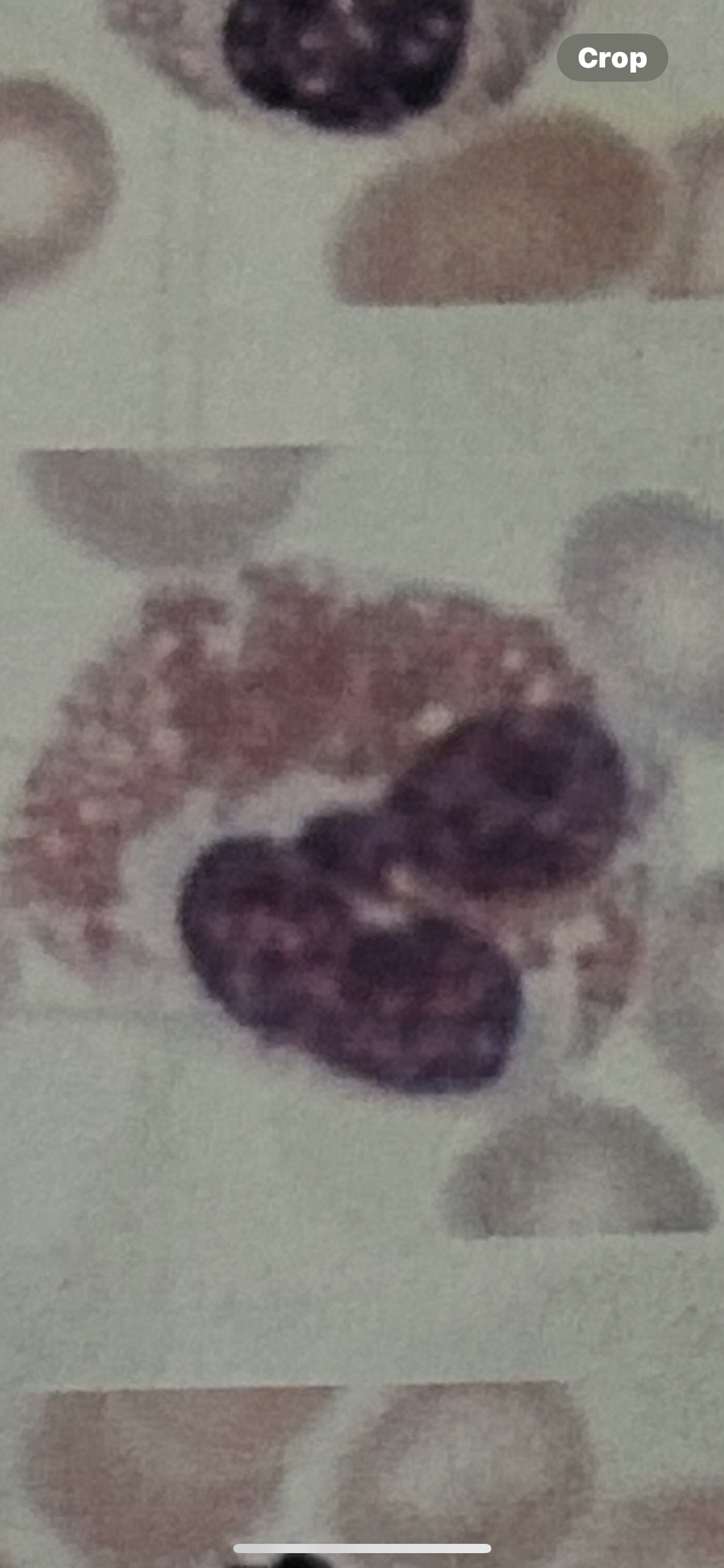 <p>WBC</p>